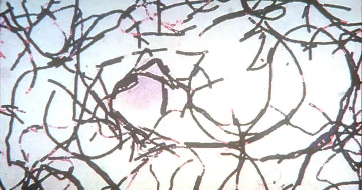 Anthrax outbreak kills more than 50 animals and infects 12 people in Zambia – National

 G trends